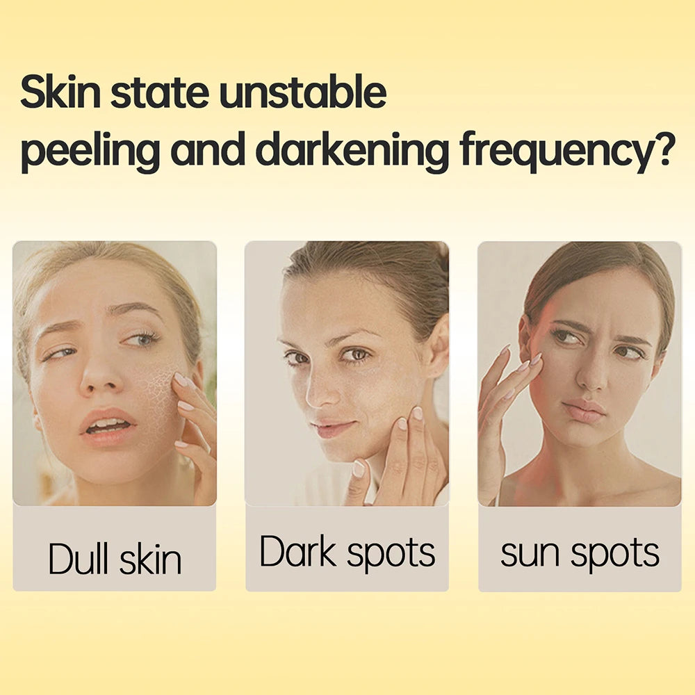 Kojic Acid Skin Care Set Anti-aging Face Cream Wrinkle Removal Facial Serum Deep Cleansing Brighten Moisturize Kojic Acid Soap